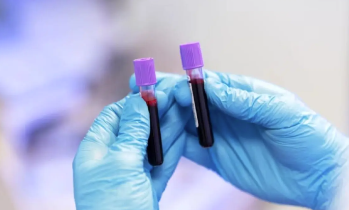 Bleeding Coagulation Disorders