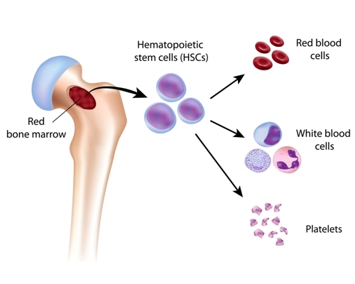 Specialized Blood Cancer Treatment in Chhatrapati Sambhajinagar | Jeevan Amrut Haematology Center