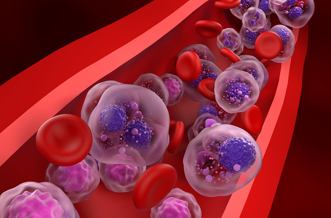 Bone Marrow Transplant in Chhatrapati Sambhajinagar