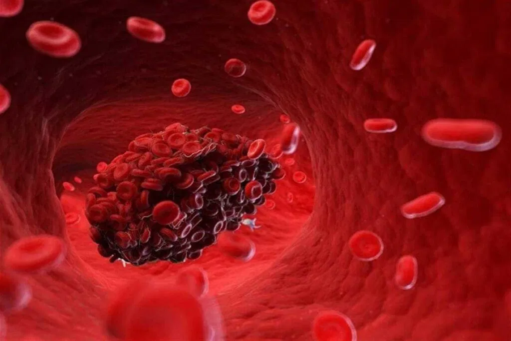 Pregnancy related blood disorders 1