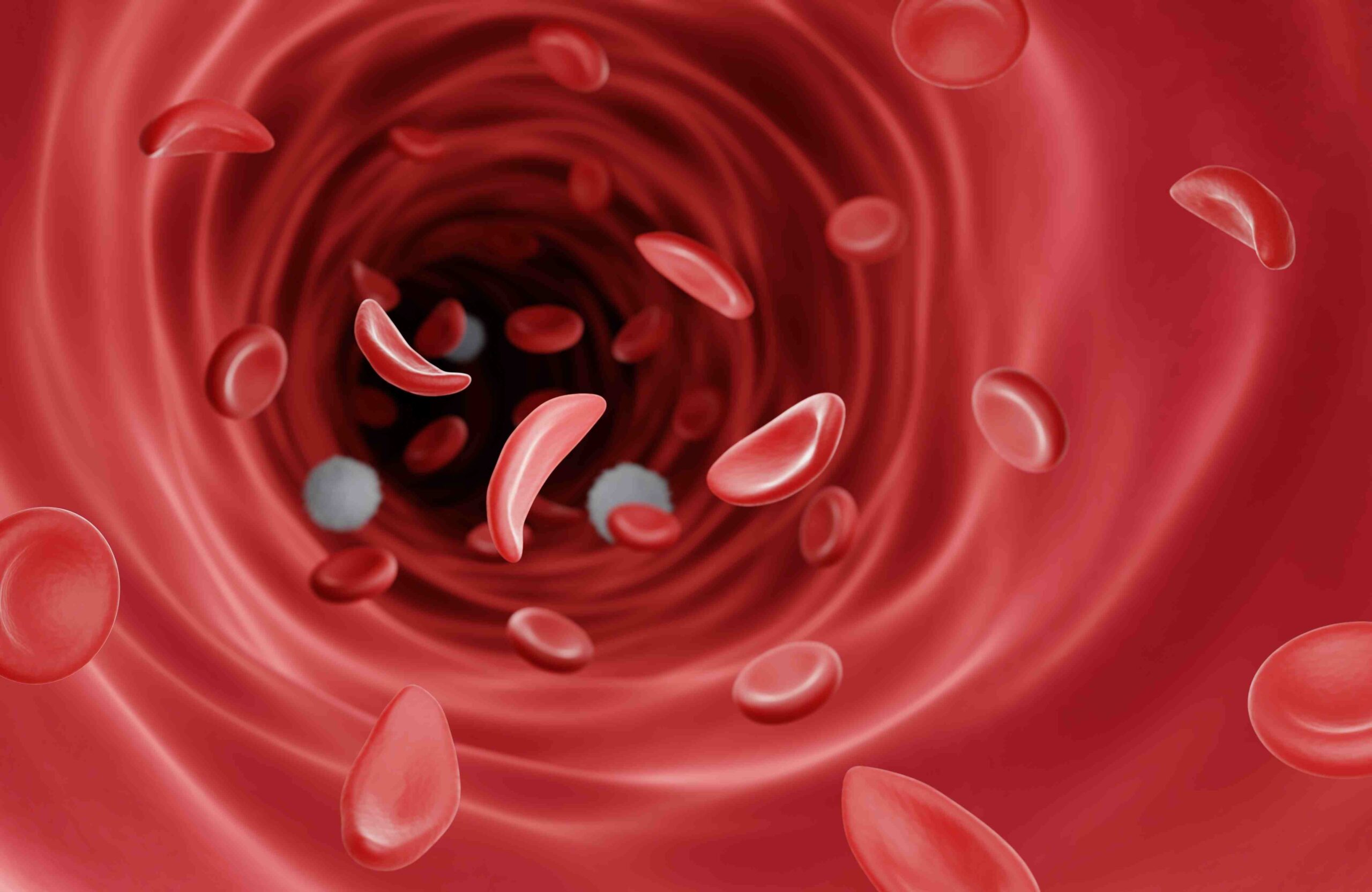 anemia2 scaled